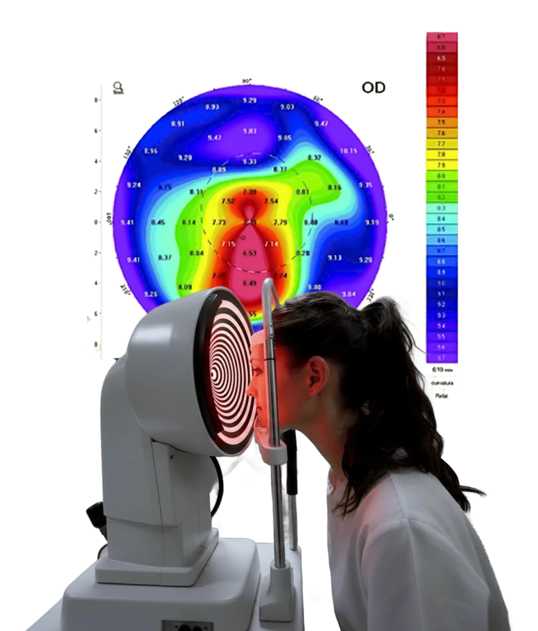 Examen de topografía corneal